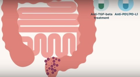 Científicos españoles descubren cómo mejorar el tratamiento inmunoterápico en cáncer de colon