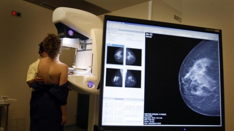 Diagnóstico, Abordaje y Tratamiento del Cáncer de Mama