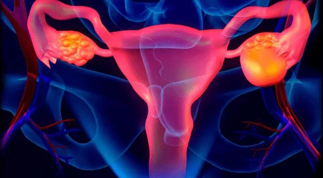 Se confirma la efectividad a largo plazo del Niraparib en el tratamiento del cáncer de ovario avanzado.